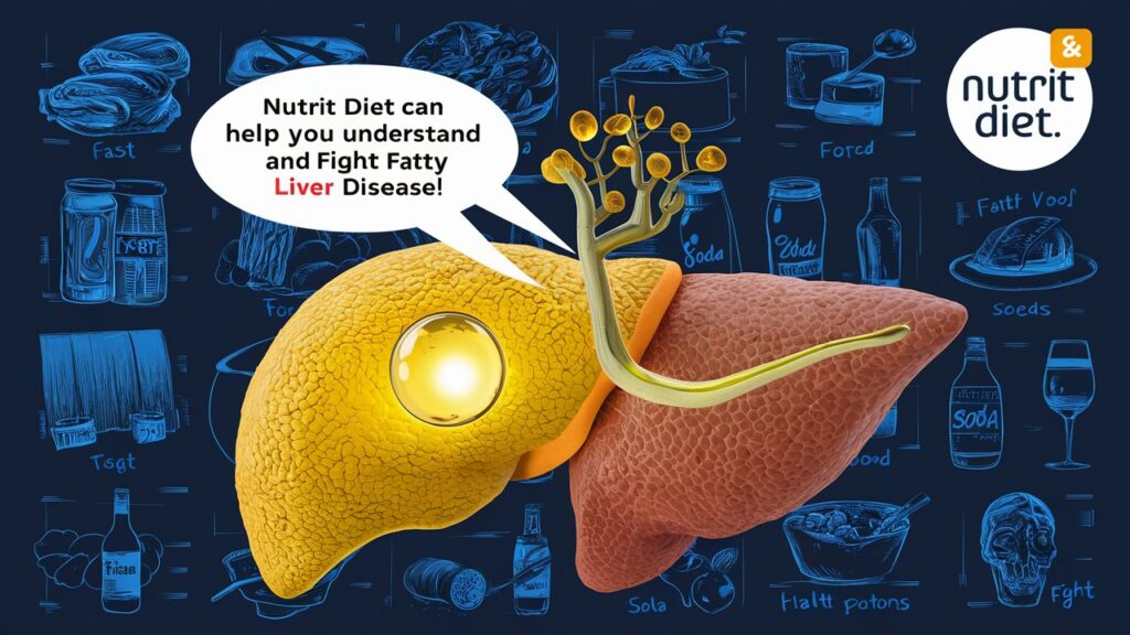 Fatty Liver